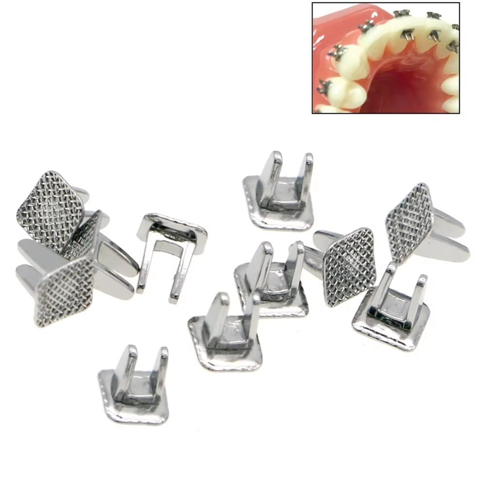 Bondable tongue spurs with rectangular mesh bases and an anterior lingual placement example