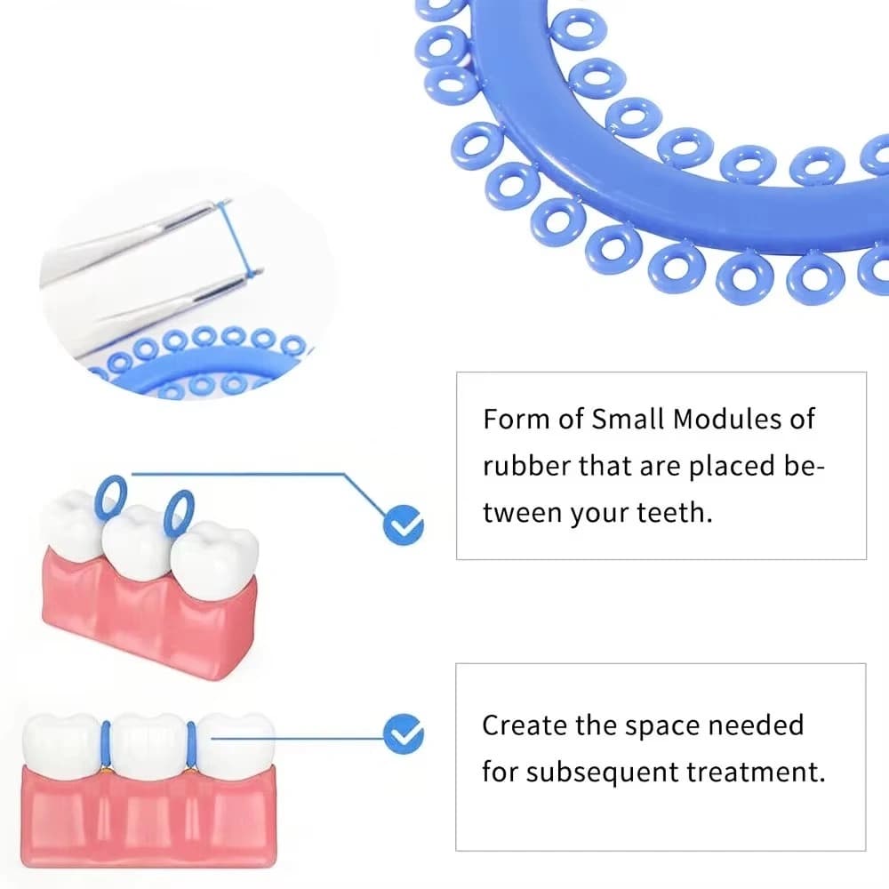 Orthodontic separator strip detail with 70 separators per strip