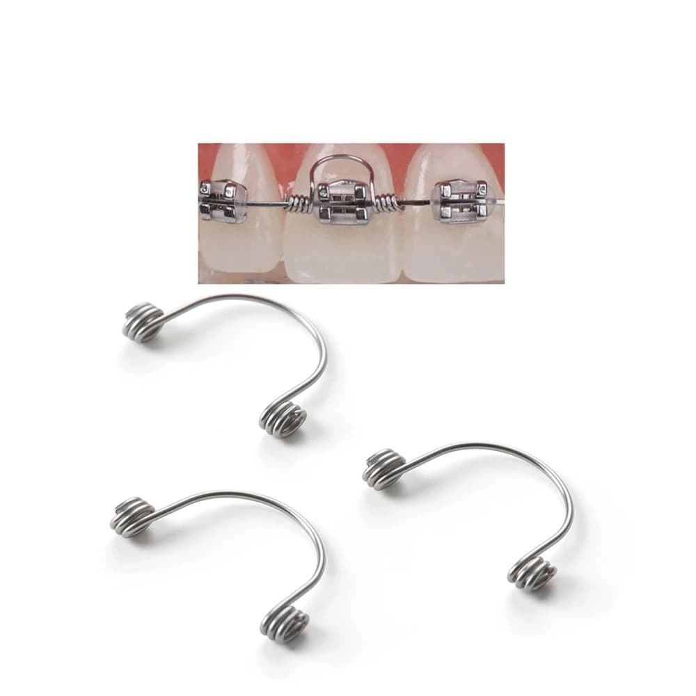 Orthodontic torquing springs shown with rectangular archwire placement
